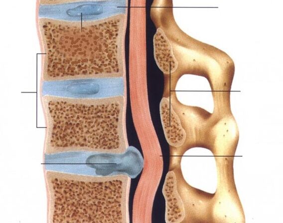 The hernia is expressed