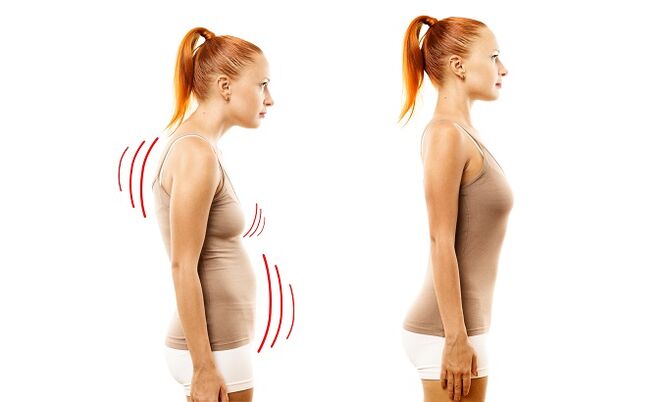 The cause of developing lumbar osteochondrosis as