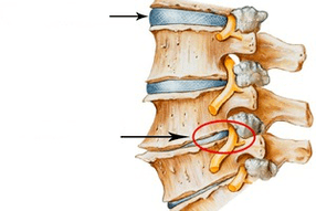 Osteochondrosis of the normal and damaged spine