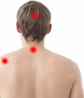 Place of pain in cervical osteochondrosis